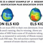 ELS Edification Plus: Igniting Curiosity, Inspiring Growth, and Shaping Young Minds with the SMILE Concept