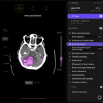 Aarthi Scans adopts Australian AI technology to elevate patient care management