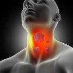 How to Treat Sore Throat?