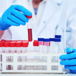 Getting sick frequently? Book a CBC test to know the cause