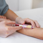 Cholesterol and Lipid Tests: Why They Matter
