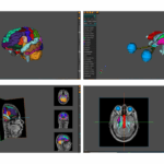 AnaVu: IIIT-Hyderabad’s 3D Anatomy Visualization Platform Transforming Medical Education