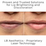 LB Aesthetics Leads the Way in Pigmentation Treatments in Delhi