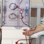 How Kidney Dialysis Is Done: Step-by-Step Overview for Beginners